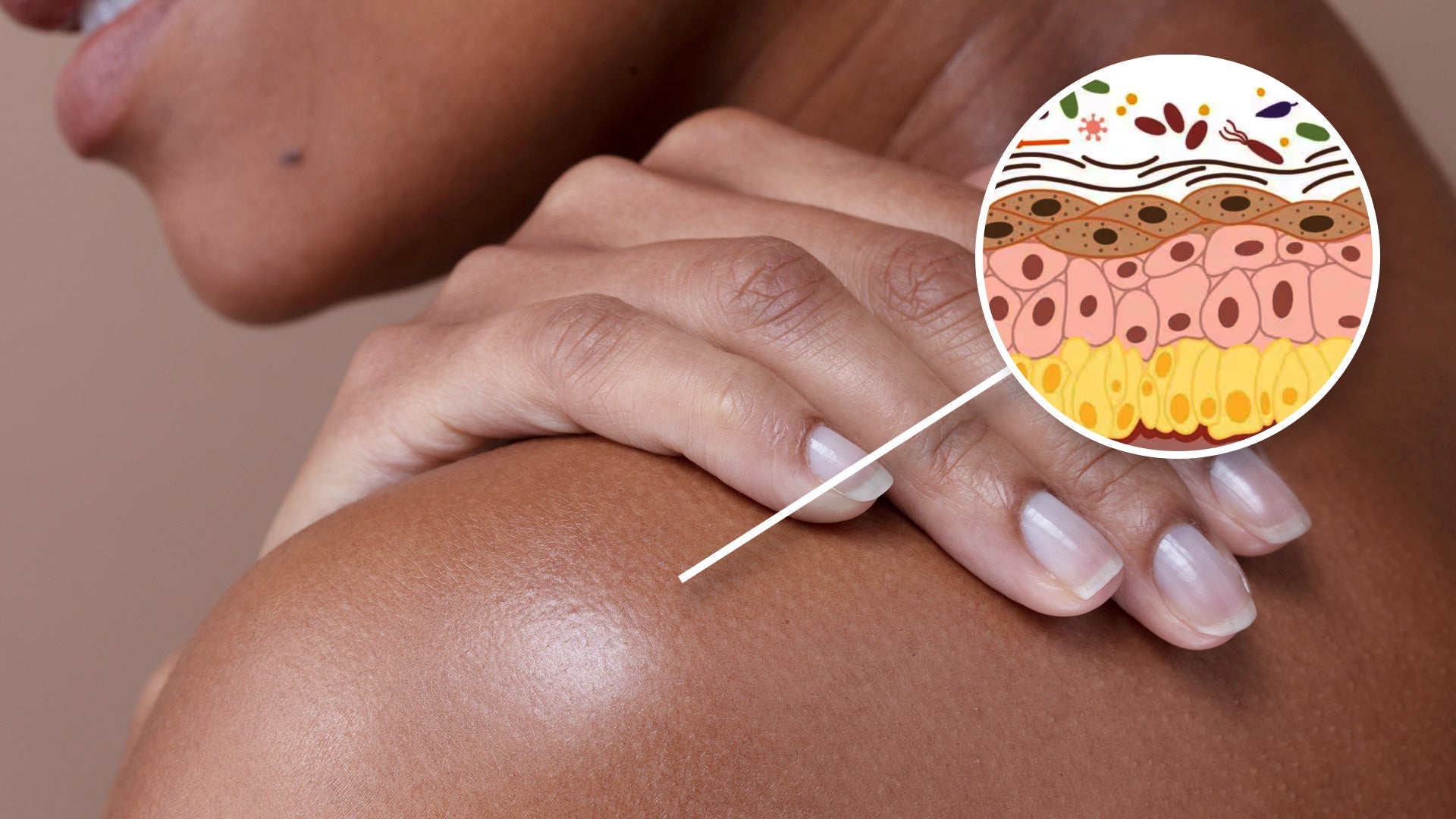 The Skin Microbiome